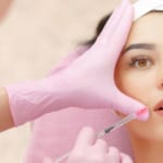 Có nên thẩm mỹ hút mỡ ghép mỡ tại Hải Phòng không?