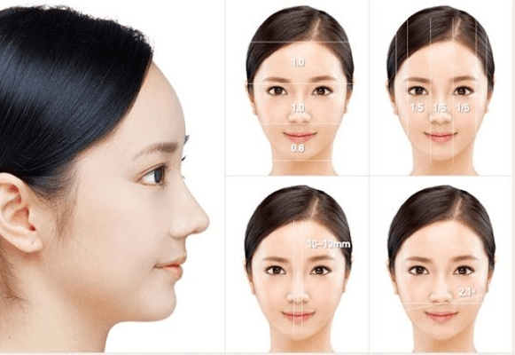 Cách phân biệt giữa 2 phương pháp nâng mũi
