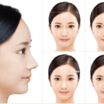 Sau khi phẫu thuật thẩm mỹ mũi cần kiêng ăn gì?