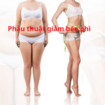 Béo phì và phẫu thuật giảm béo phì tại Dr Tiến