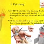 Bài giảng nhiễm trùng bàn tay