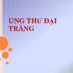 Bài giảng ung thư đại tràng